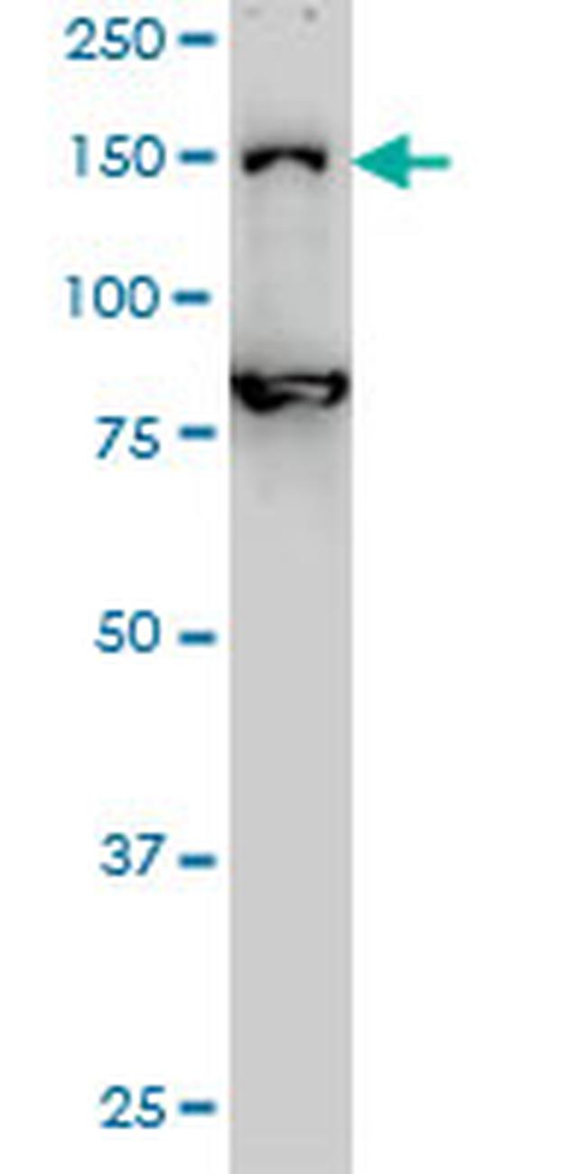 DHX8 Antibody in Western Blot (WB)