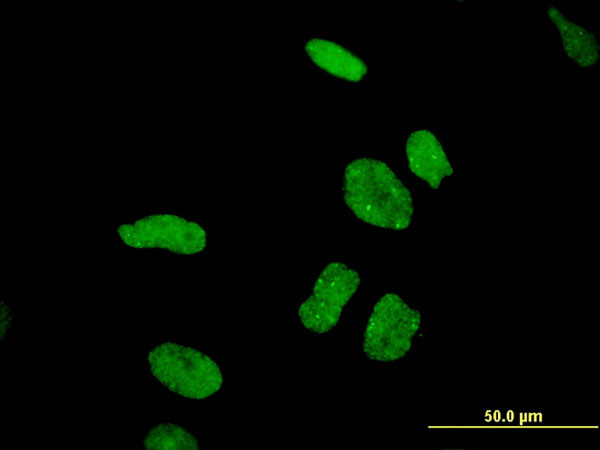 DDX11 Antibody in Immunocytochemistry (ICC/IF)
