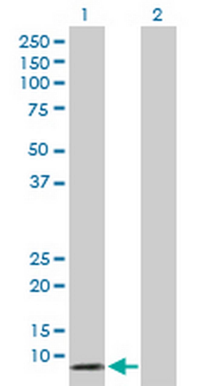 DEFA5 Antibody in Western Blot (WB)