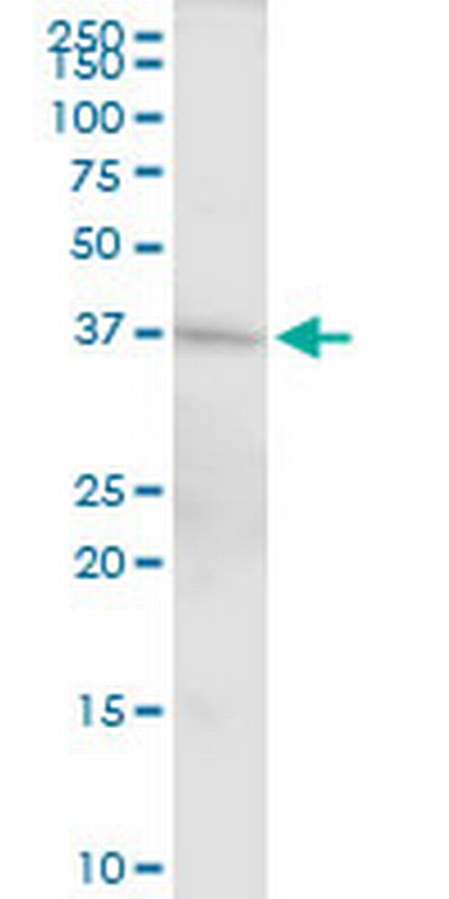 DFFA Antibody in Western Blot (WB)