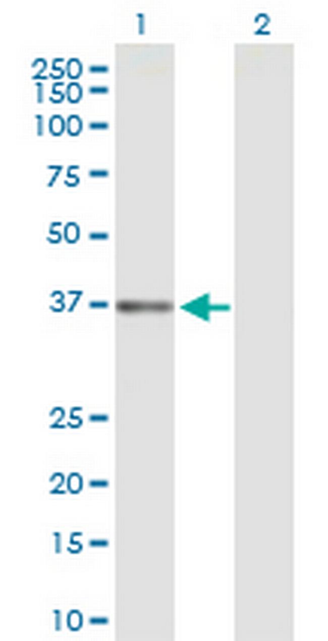 DFFB Antibody in Western Blot (WB)