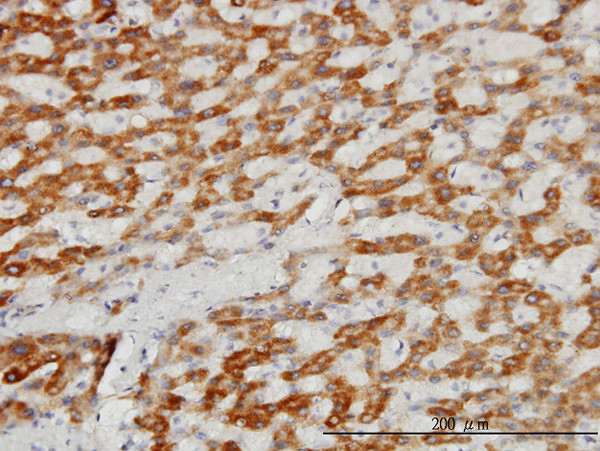 TIMM8A Antibody in Immunohistochemistry (Paraffin) (IHC (P))