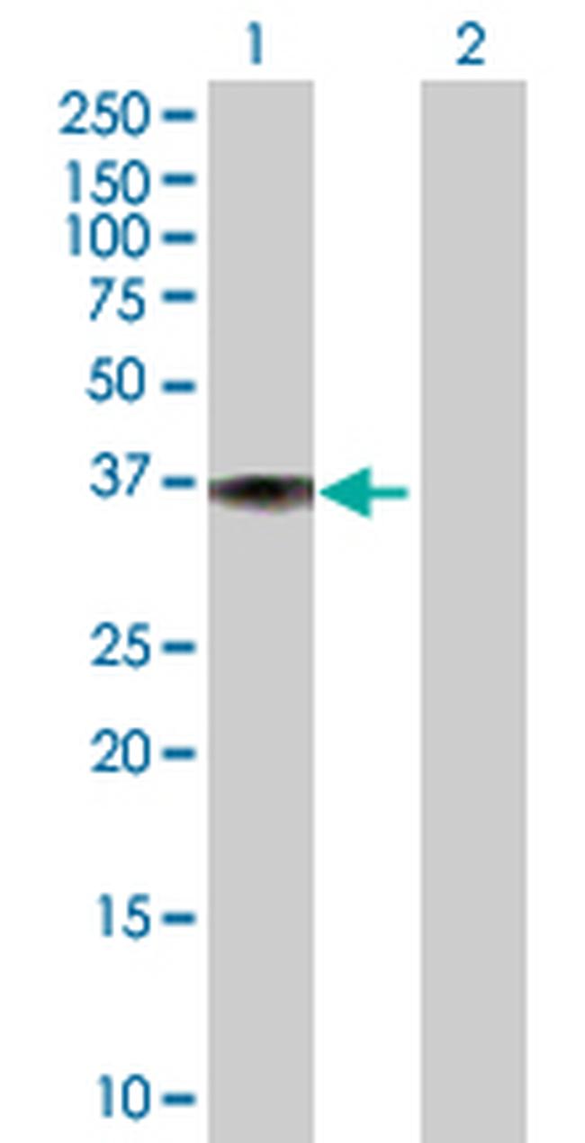 DFNA5 Antibody in Western Blot (WB)