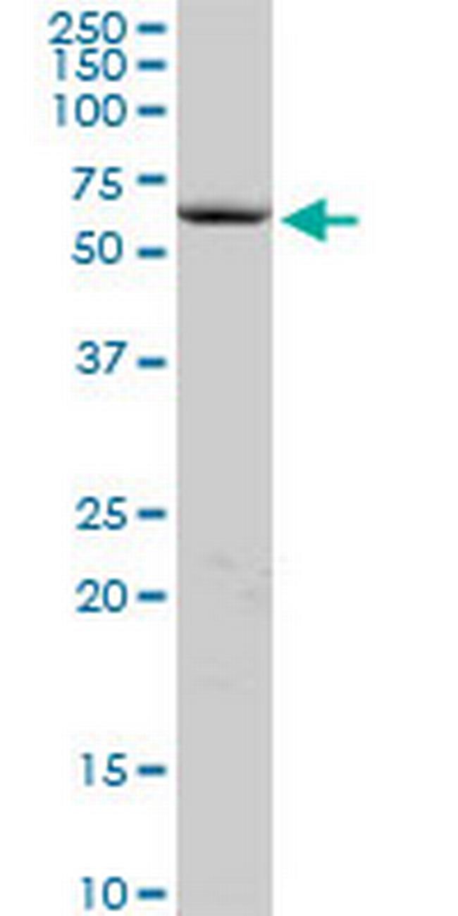 COCH Antibody in Western Blot (WB)
