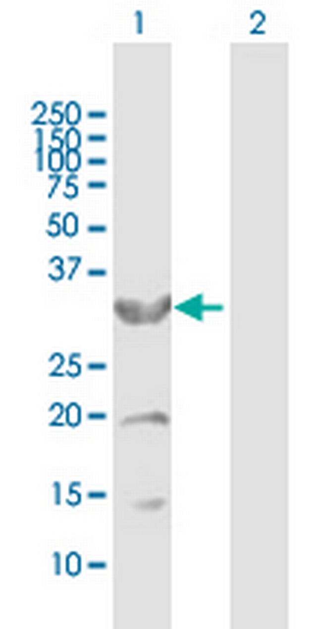 CYB5R3 Antibody in Western Blot (WB)