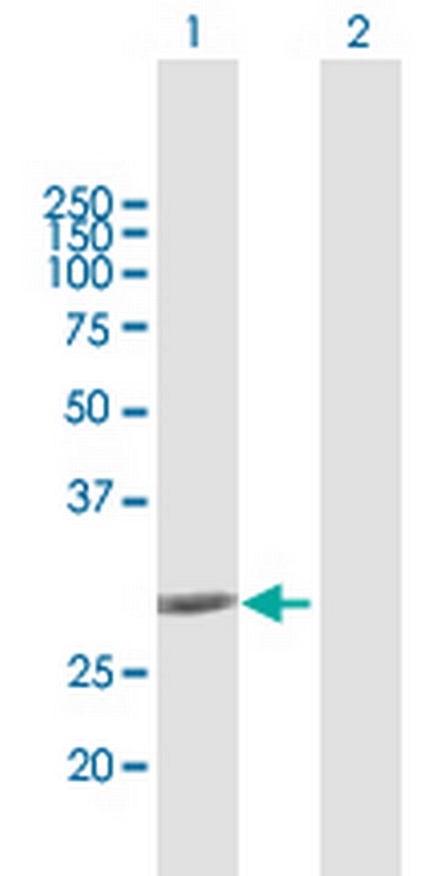 NQO1 Antibody in Western Blot (WB)