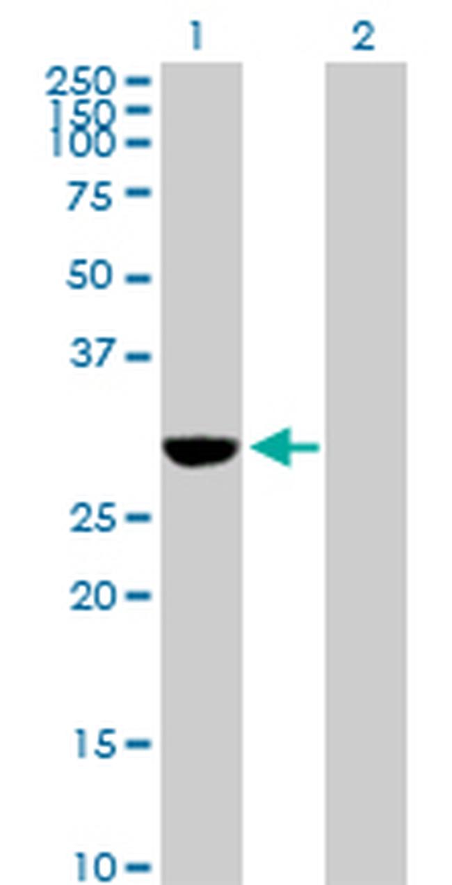 NQO1 Antibody in Western Blot (WB)