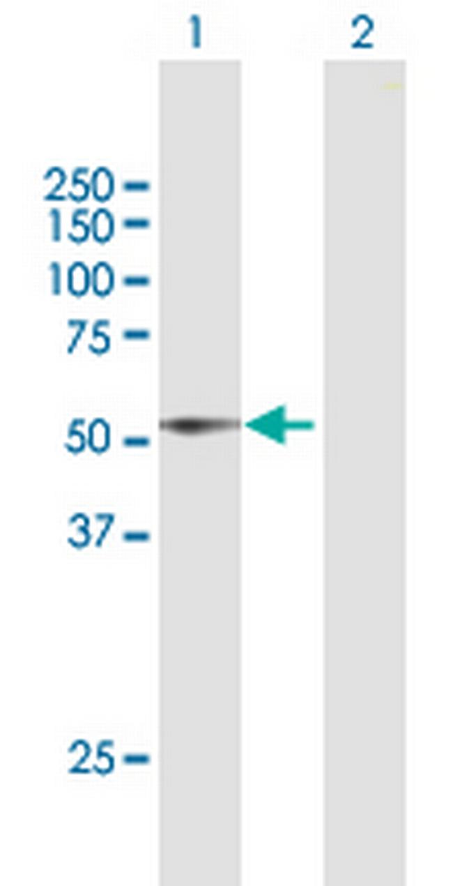 DIAPH1 Antibody in Western Blot (WB)