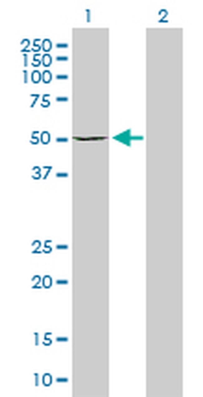 DIAPH1 Antibody in Western Blot (WB)