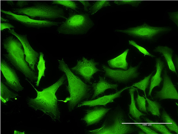SEPT1 Antibody in Immunocytochemistry (ICC/IF)