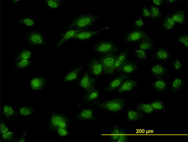 DLX1 Antibody in Immunocytochemistry (ICC/IF)