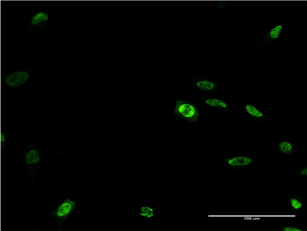 DLX2 Antibody in Immunocytochemistry (ICC/IF)
