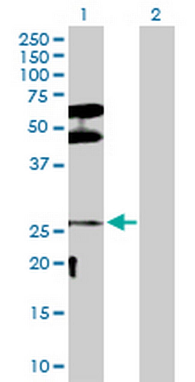 DLX3 Antibody in Western Blot (WB)
