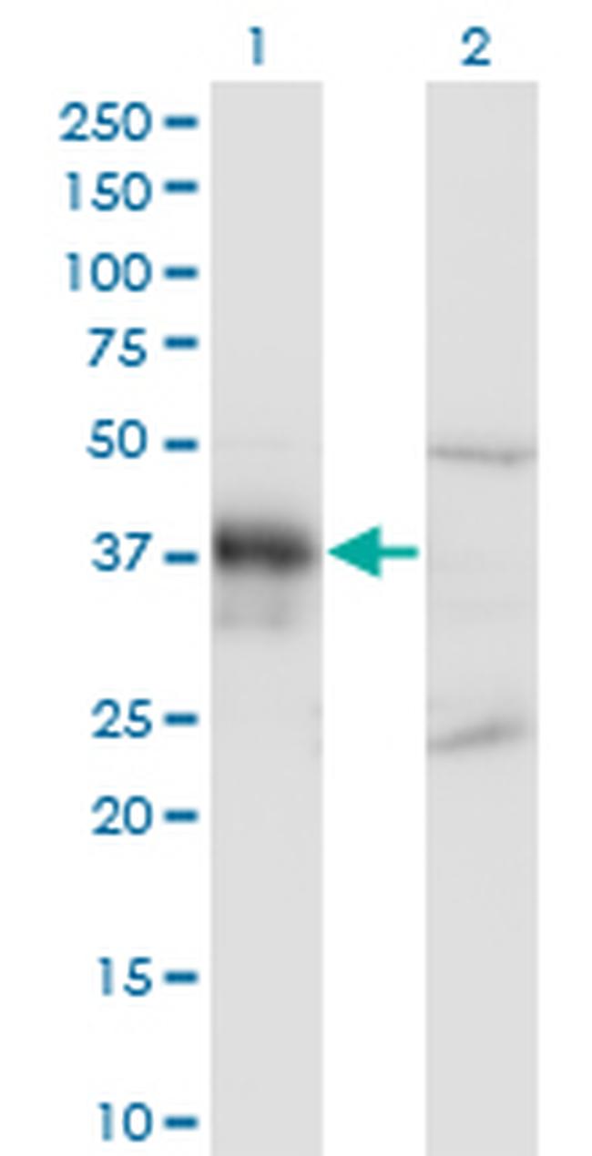 DLX3 Antibody in Western Blot (WB)