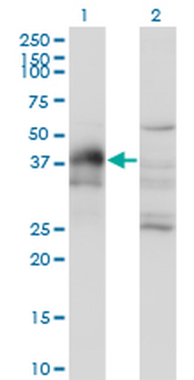 DLX3 Antibody in Western Blot (WB)