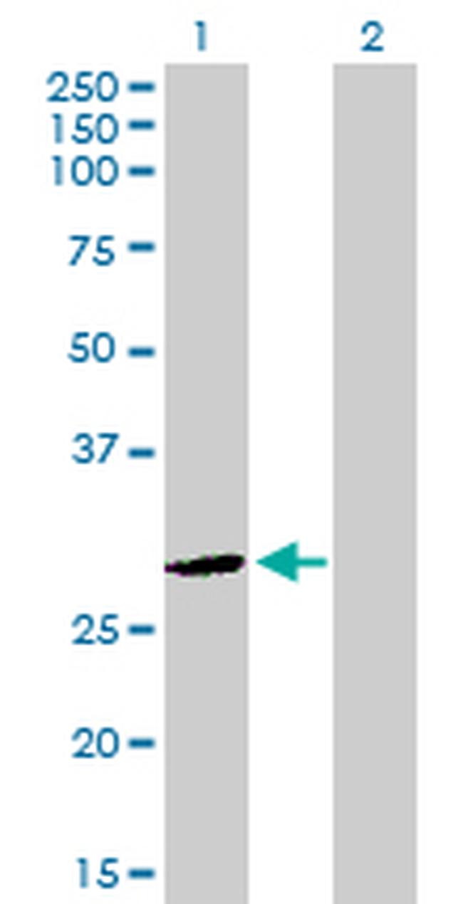 DLX4 Antibody in Western Blot (WB)