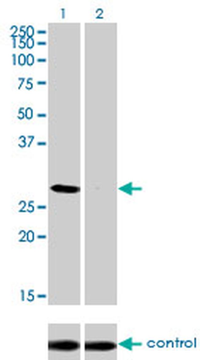 DLX4 Antibody in Western Blot (WB)