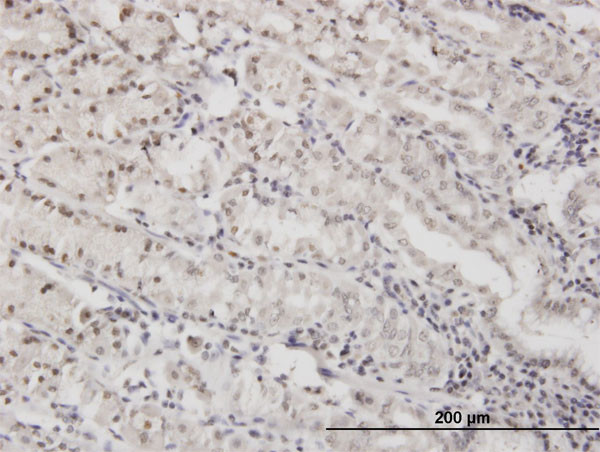 DLX5 Antibody in Immunohistochemistry (Paraffin) (IHC (P))