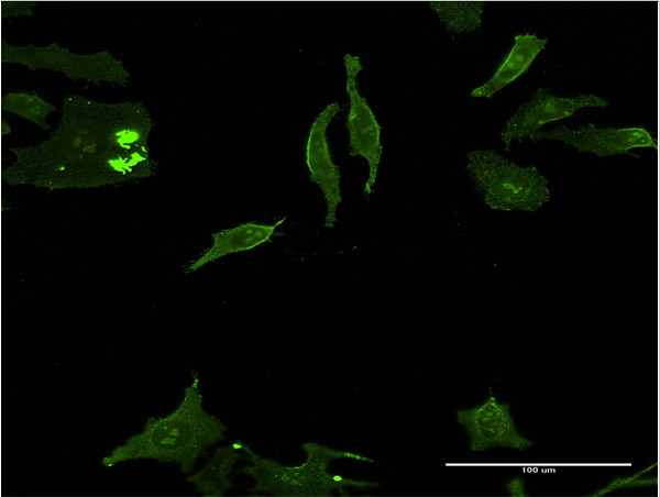 DLX5 Antibody in Immunocytochemistry (ICC/IF)