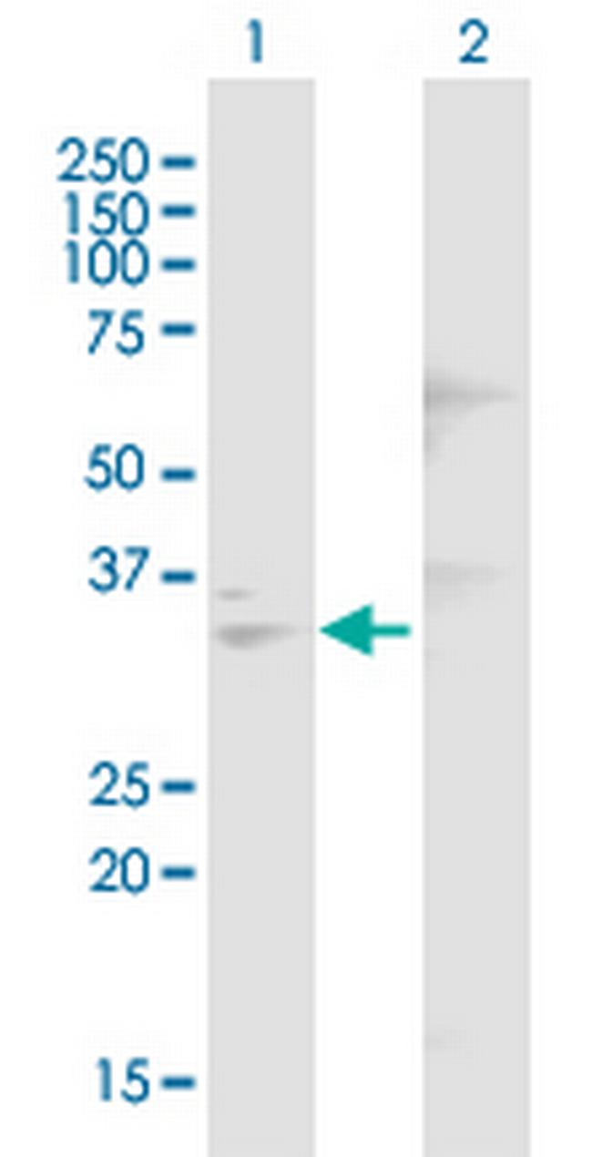 DNASE1 Antibody in Western Blot (WB)