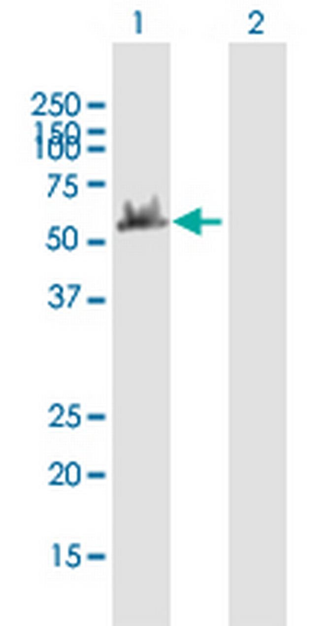 DYNC1LI2 Antibody in Western Blot (WB)