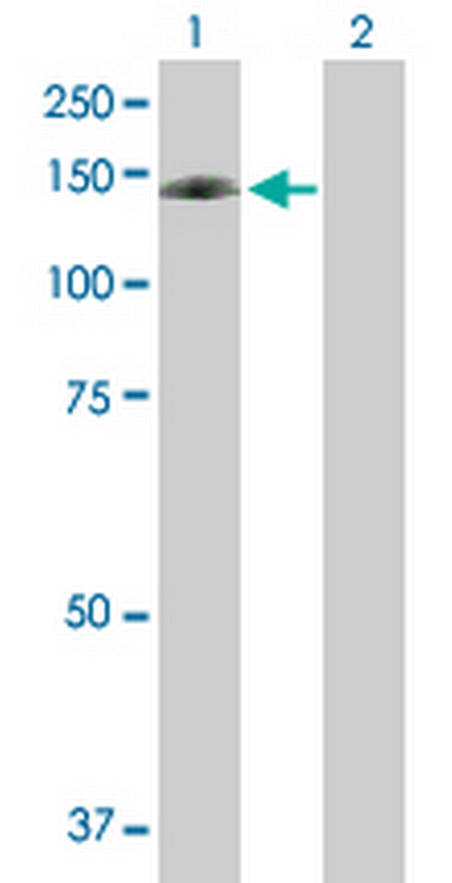 DNMT3A Antibody in Western Blot (WB)