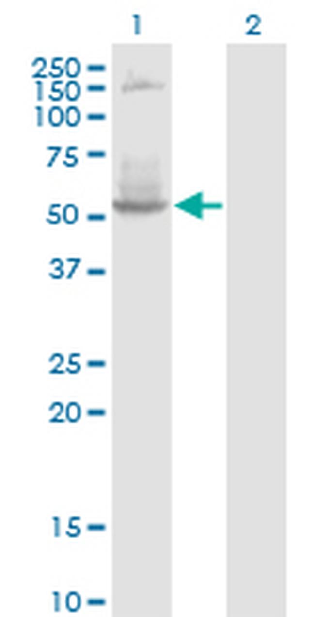 DNTT Antibody in Western Blot (WB)