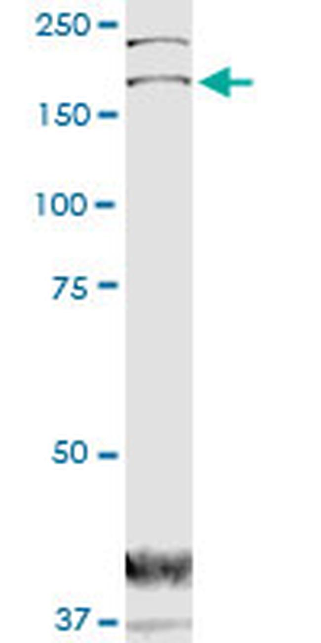 DOCK1 Antibody in Western Blot (WB)