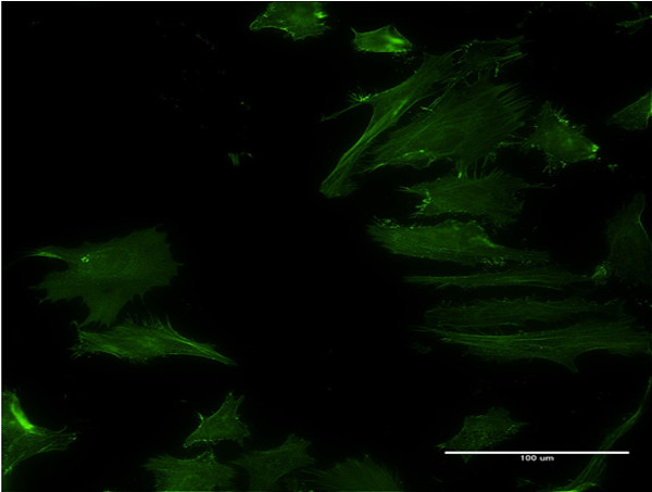 DPH2 Antibody in Immunocytochemistry (ICC/IF)