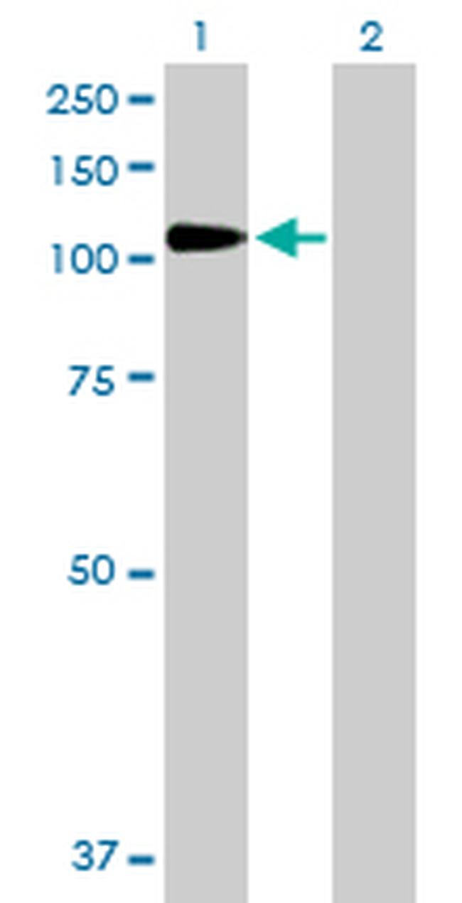 DPP4 Antibody in Western Blot (WB)