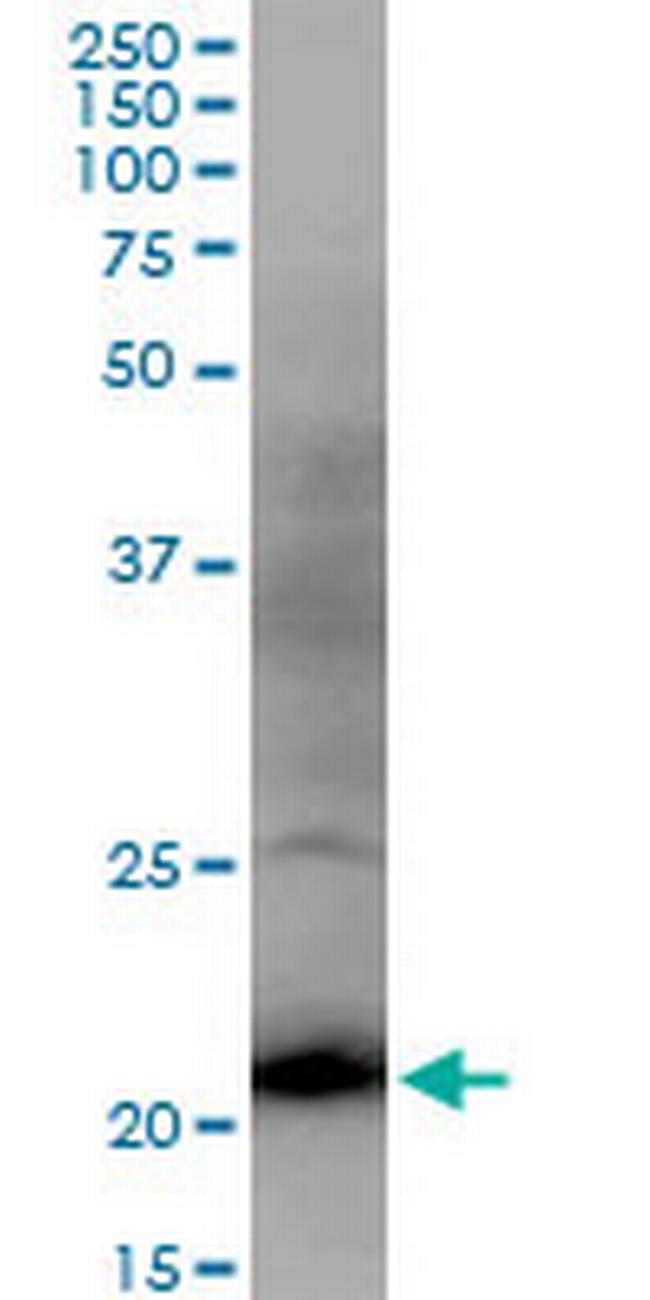 DR1 Antibody in Western Blot (WB)