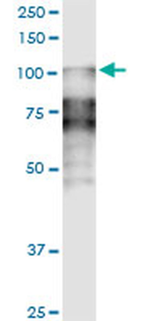 DSC2 Antibody in Western Blot (WB)