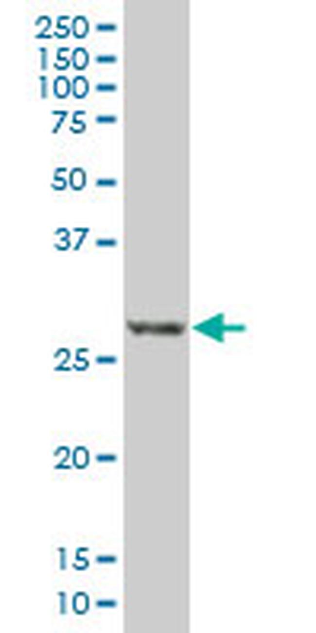 DSCR1 Antibody in Western Blot (WB)