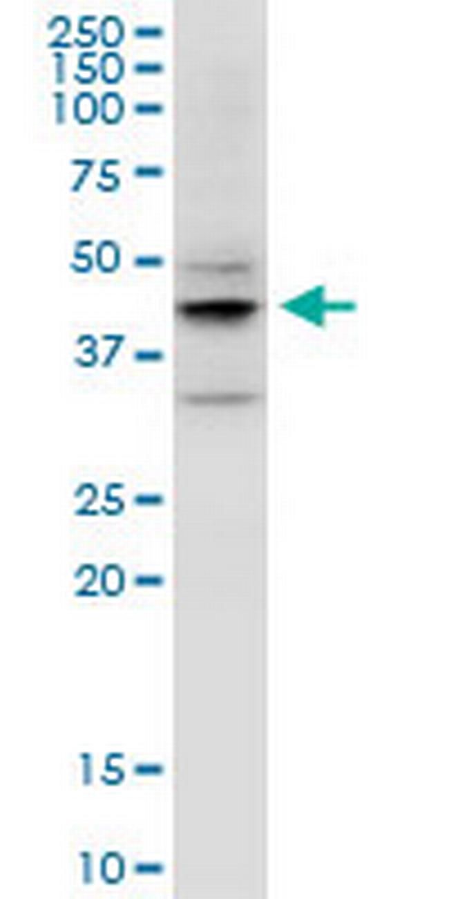 EPYC Antibody in Western Blot (WB)
