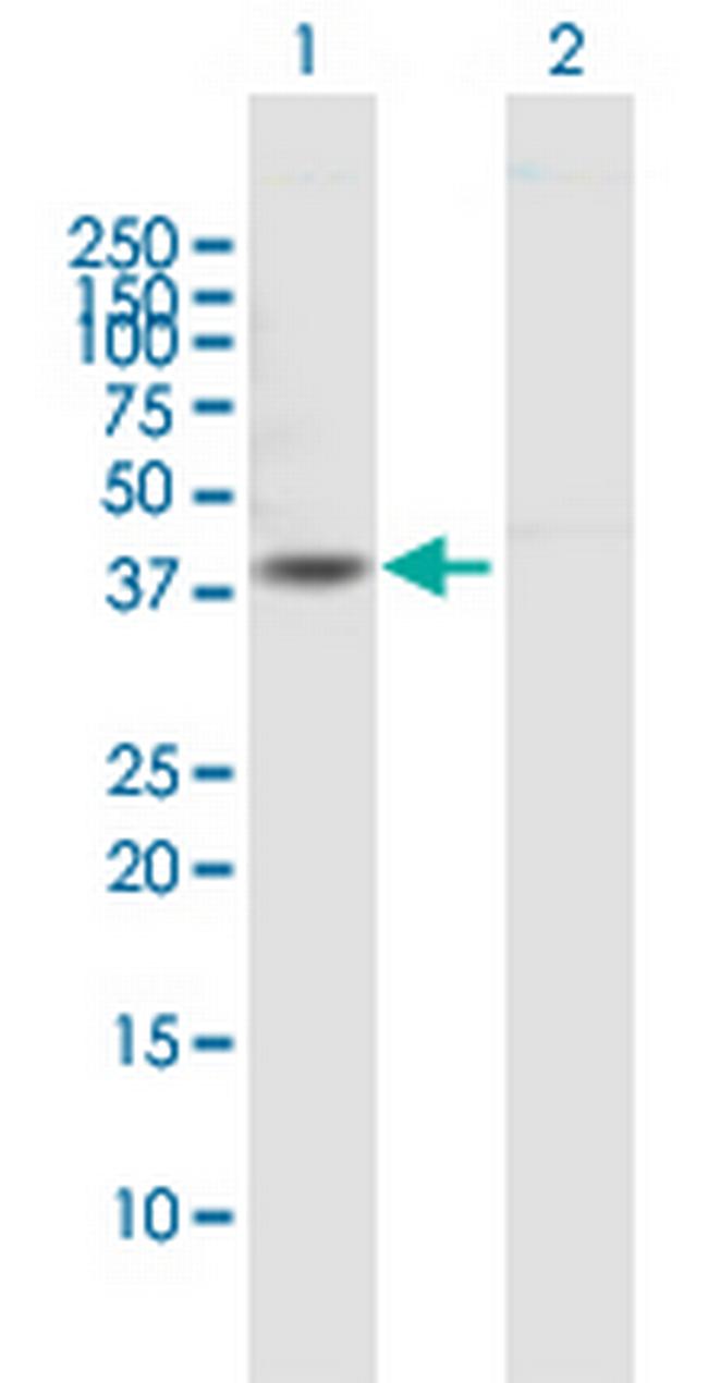 DTNA Antibody in Western Blot (WB)