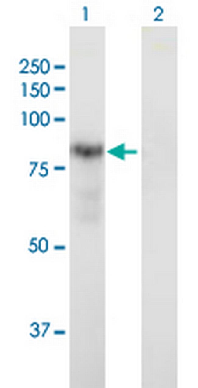 DTNA Antibody in Western Blot (WB)