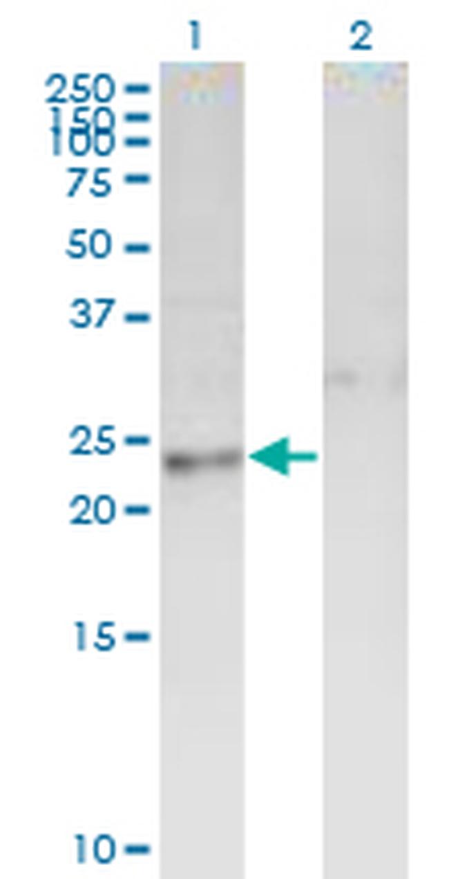 DTYMK Antibody in Western Blot (WB)
