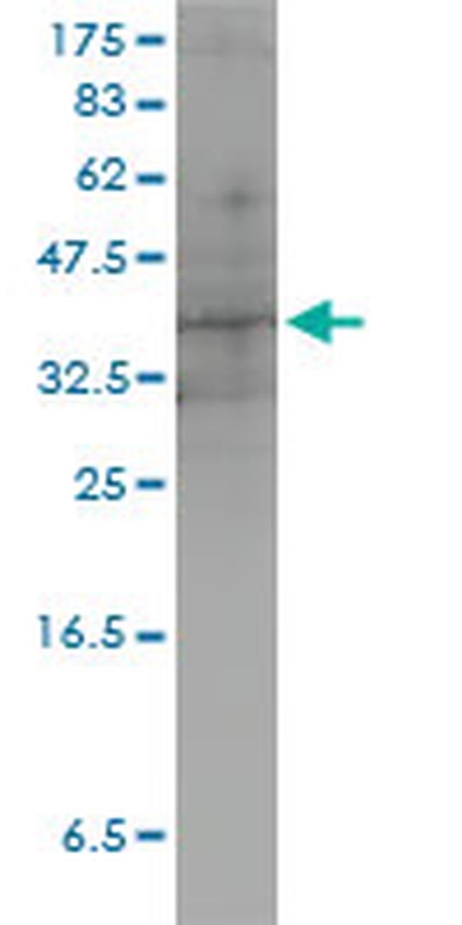 DUSP4 Monoclonal Antibody (3D6G6) (H00001846M01)