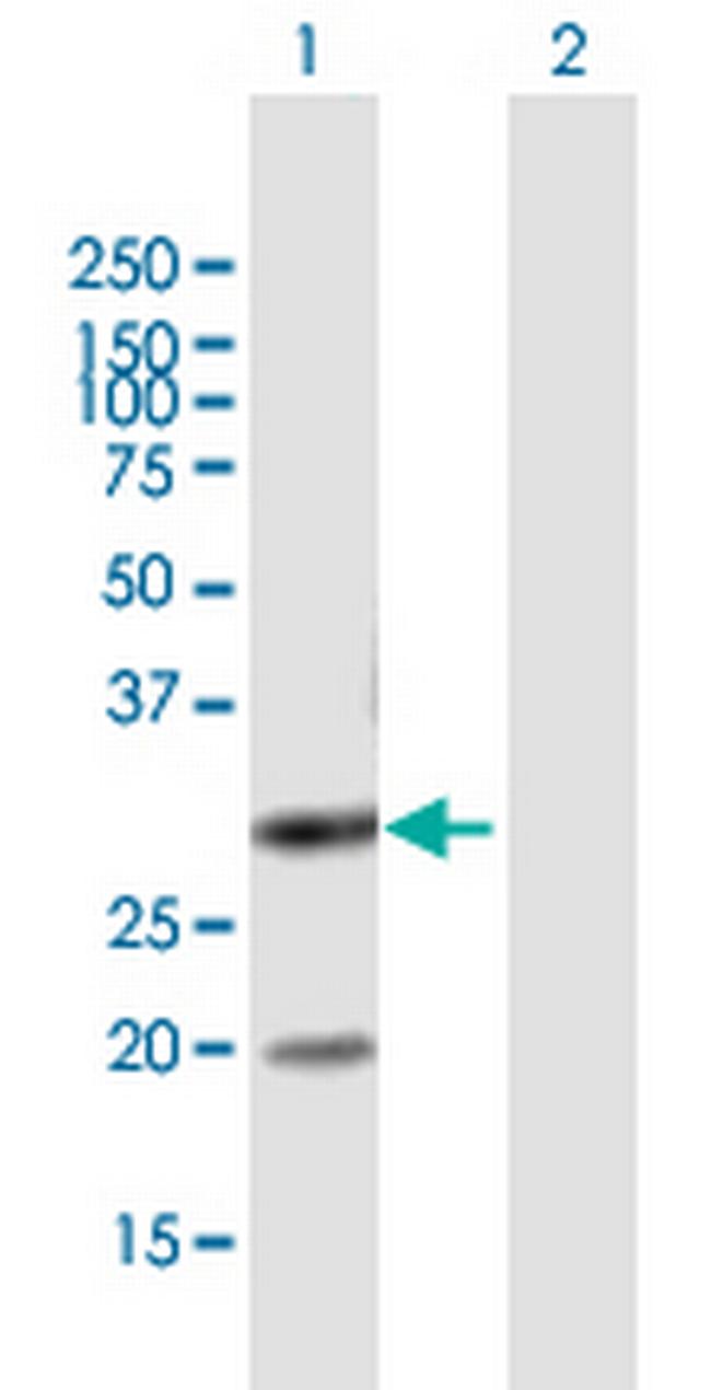 DUT Antibody in Western Blot (WB)
