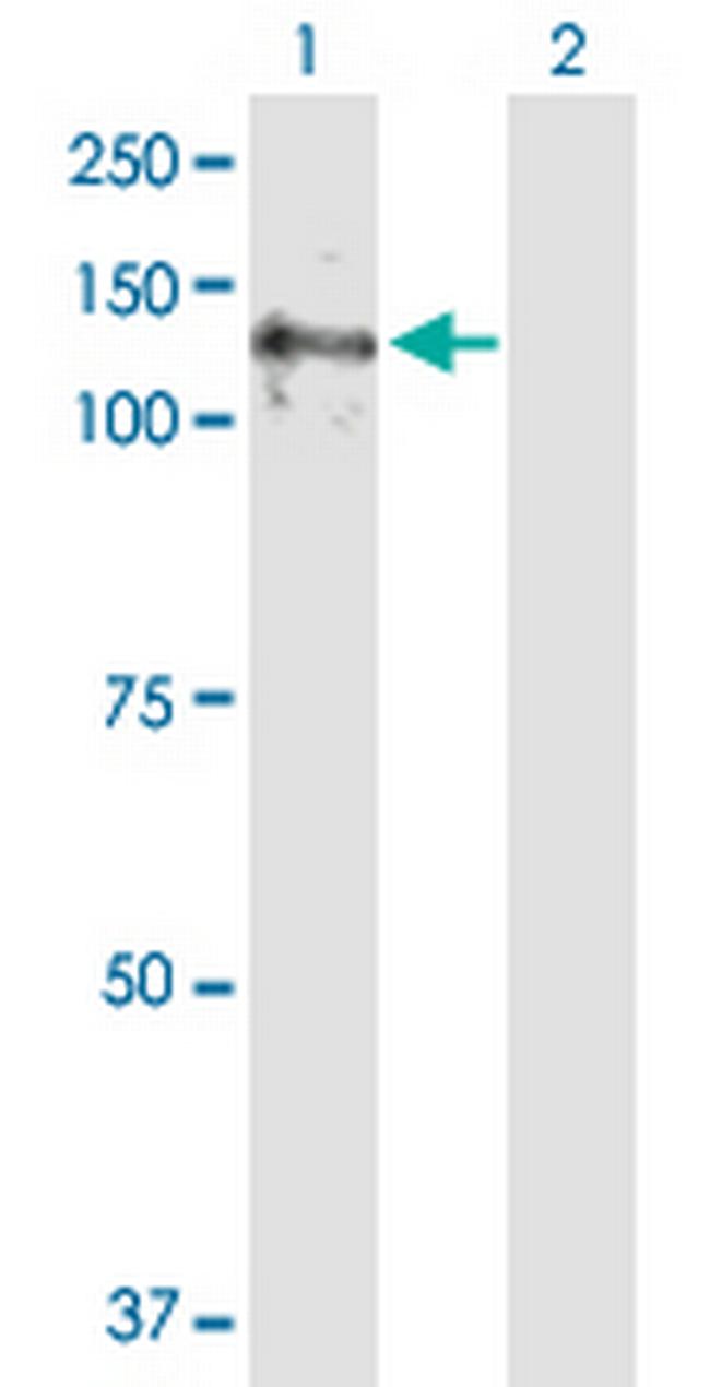 E4F1 Antibody in Western Blot (WB)