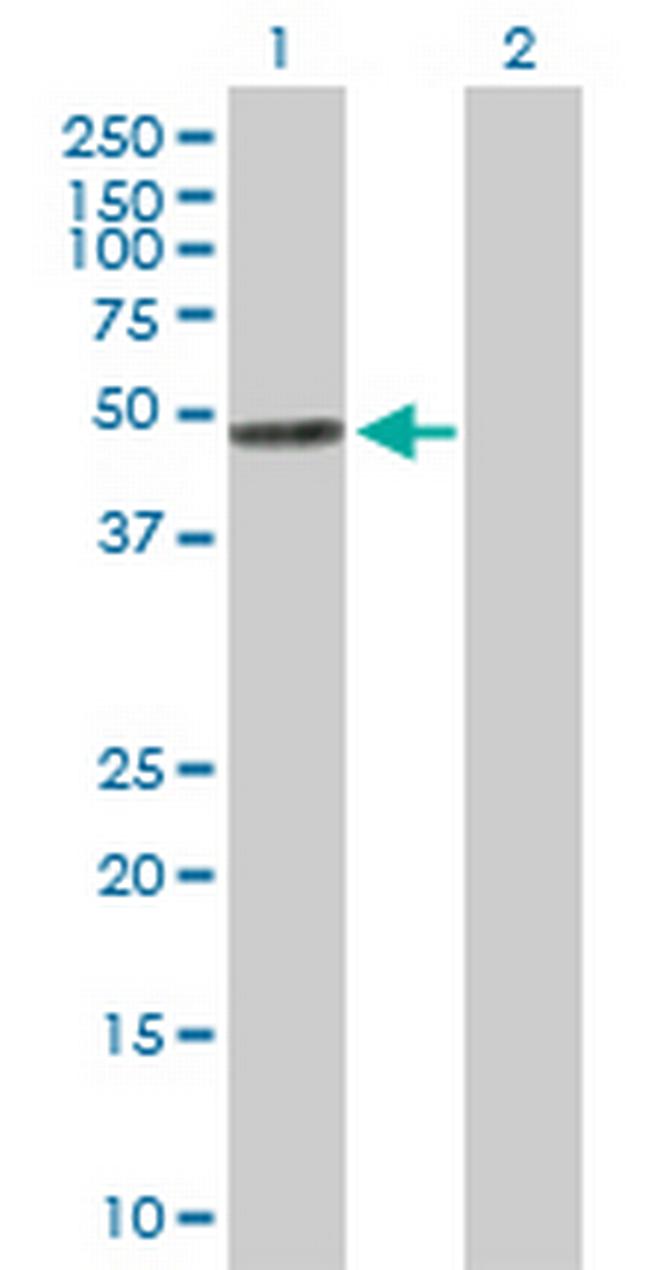 ECGF1 Antibody in Western Blot (WB)