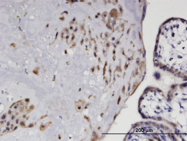 EDG3 Antibody in Immunohistochemistry (Paraffin) (IHC (P))