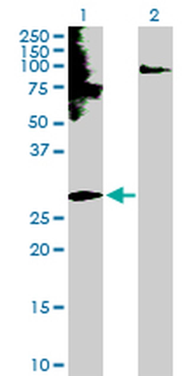 EDN3 Antibody in Western Blot (WB)