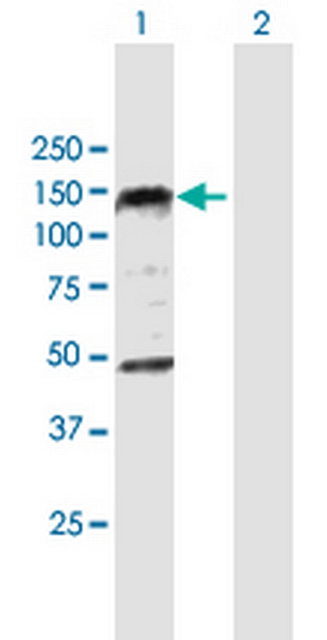 PHC1 Antibody in Western Blot (WB)