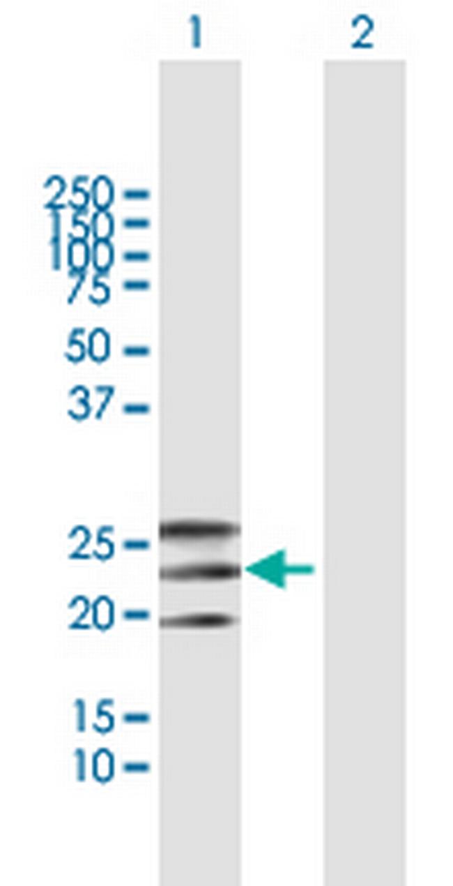 EFNA2 Antibody in Western Blot (WB)