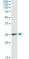 EFNA3 Antibody in Immunoprecipitation (IP)