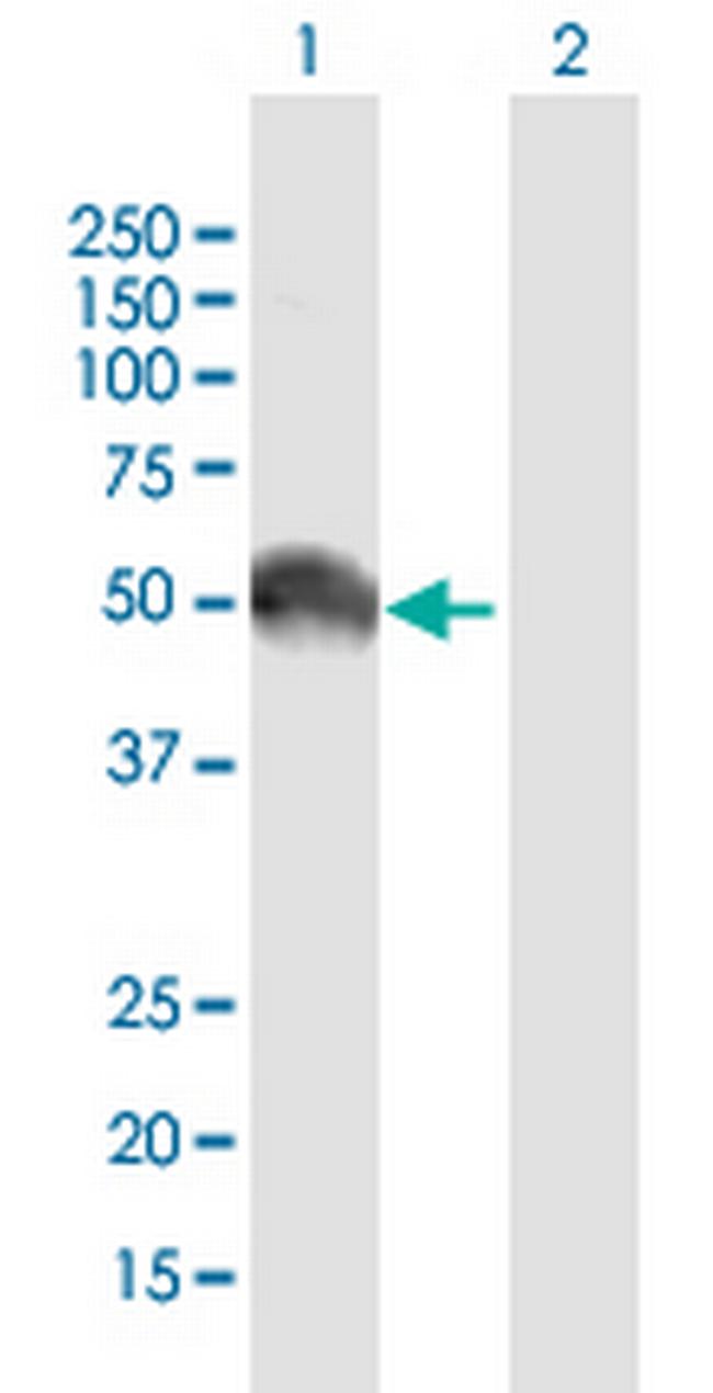 EGFR Antibody in Western Blot (WB)