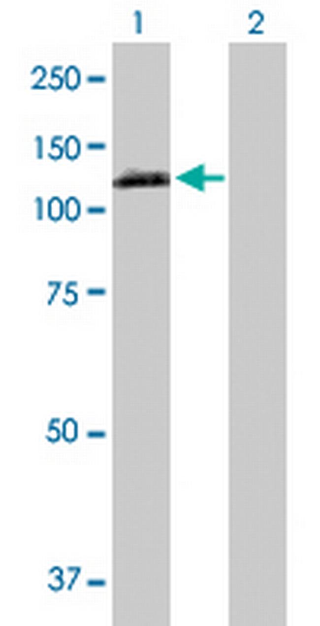 EPHA2 Antibody in Western Blot (WB)