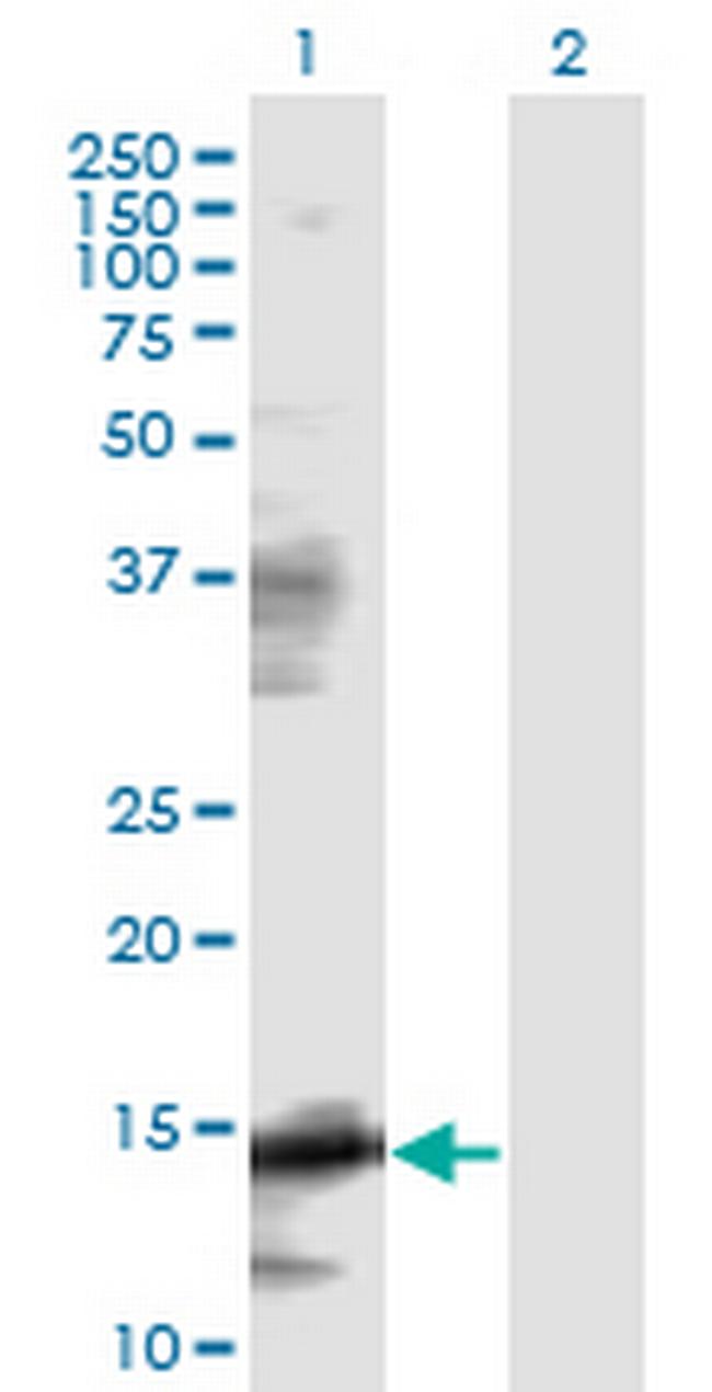EIF5A Antibody in Western Blot (WB)