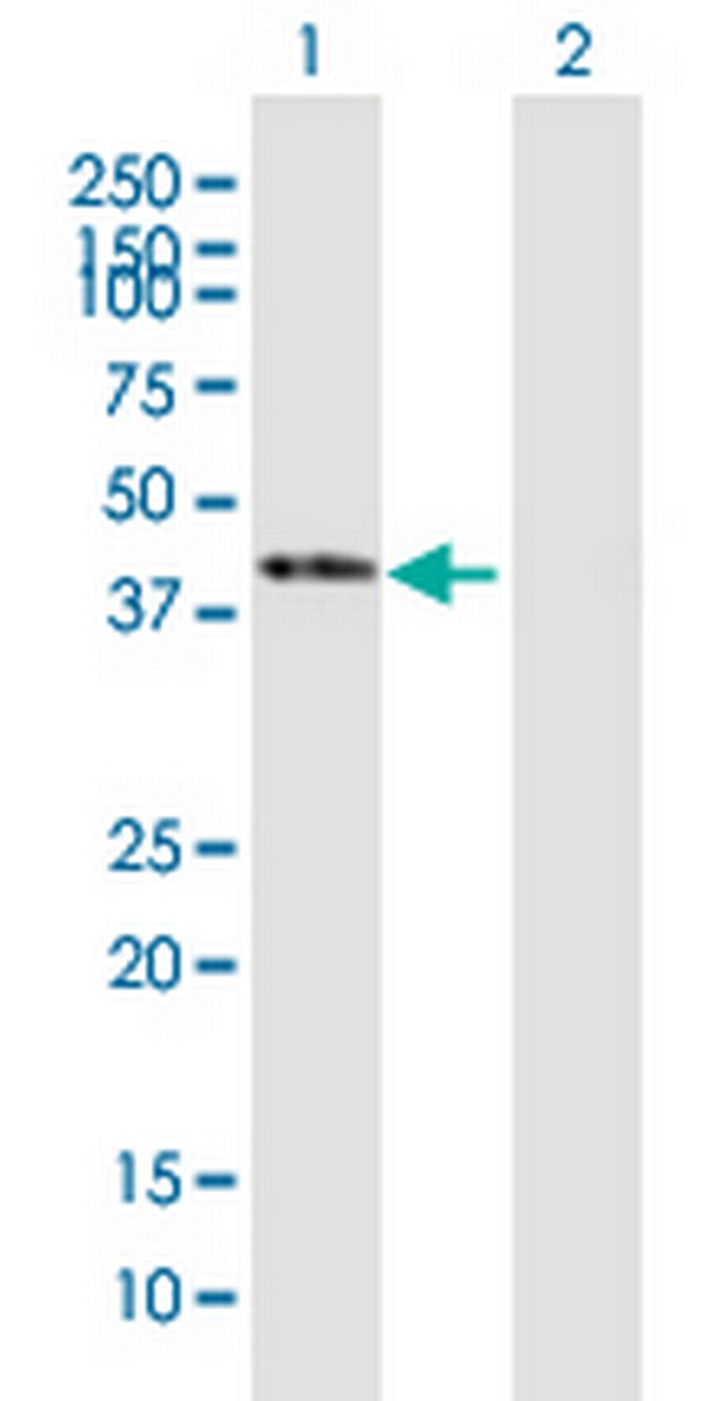 SERPINB1 Antibody in Western Blot (WB)